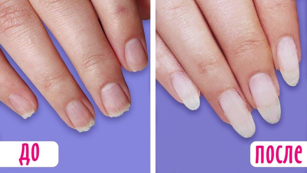 как отрастить быстро ногти