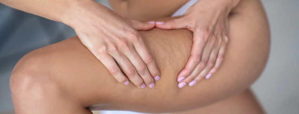 как сделать антицеллюлитный массаж дома