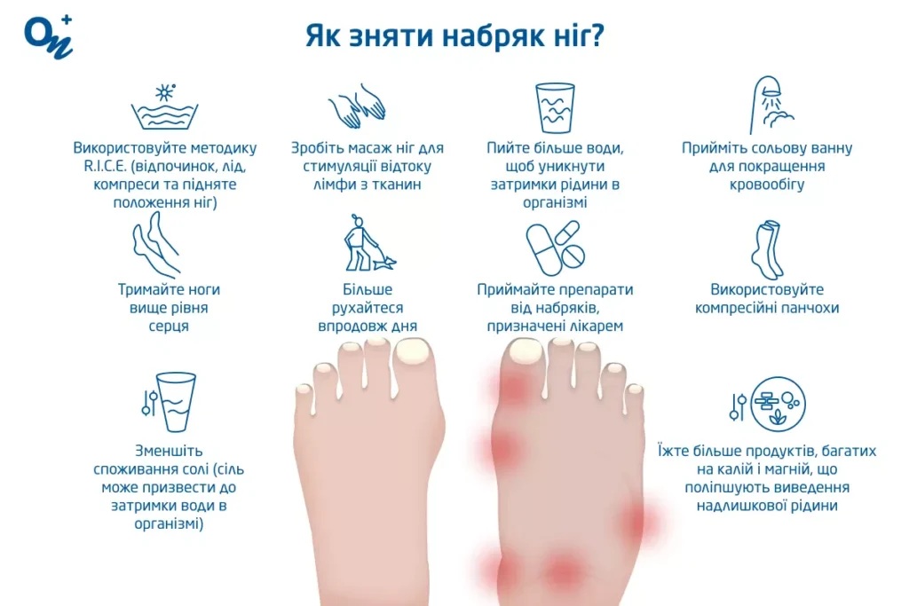 чому отікають ноги