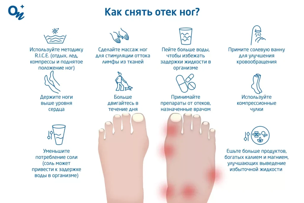 почему отекают ноги