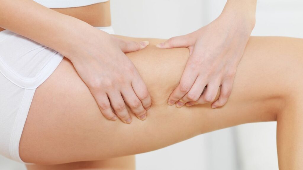 як прибрати целюліт з ніг