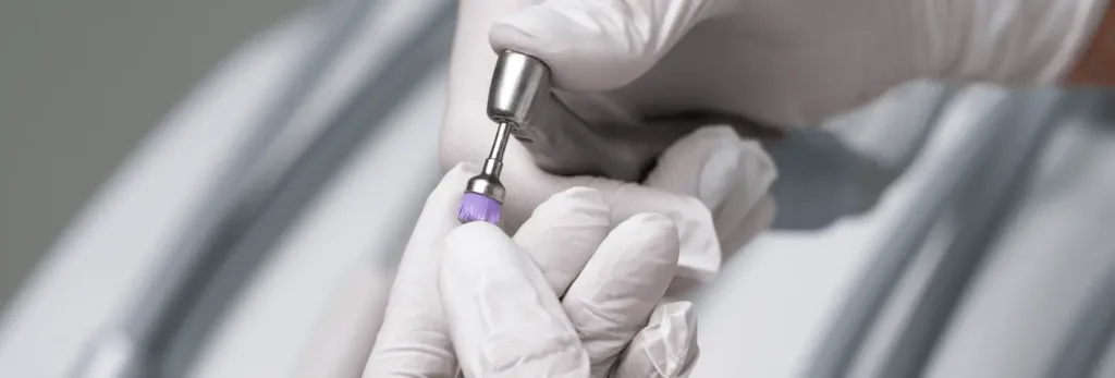 Імплантація Osstem