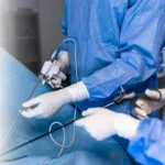 The surgeon's holing the instrument in abdomen of patient. The surgeon's doing laparoscopic surgery in the operating room. Minimally invasive surgery.